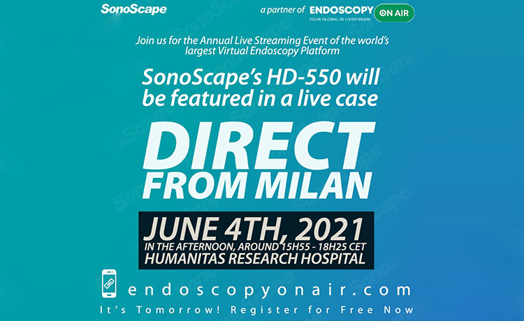 SONOSCAPE HD 5050 Presente en Evento Global de Endoscopia en vivo y en directo este 4 de Junio.
